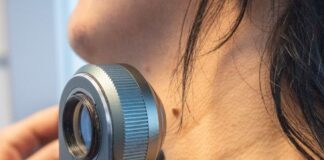 Río Grande abre las inscripciones para una nueva campaña de detección precoz de cáncer de piel